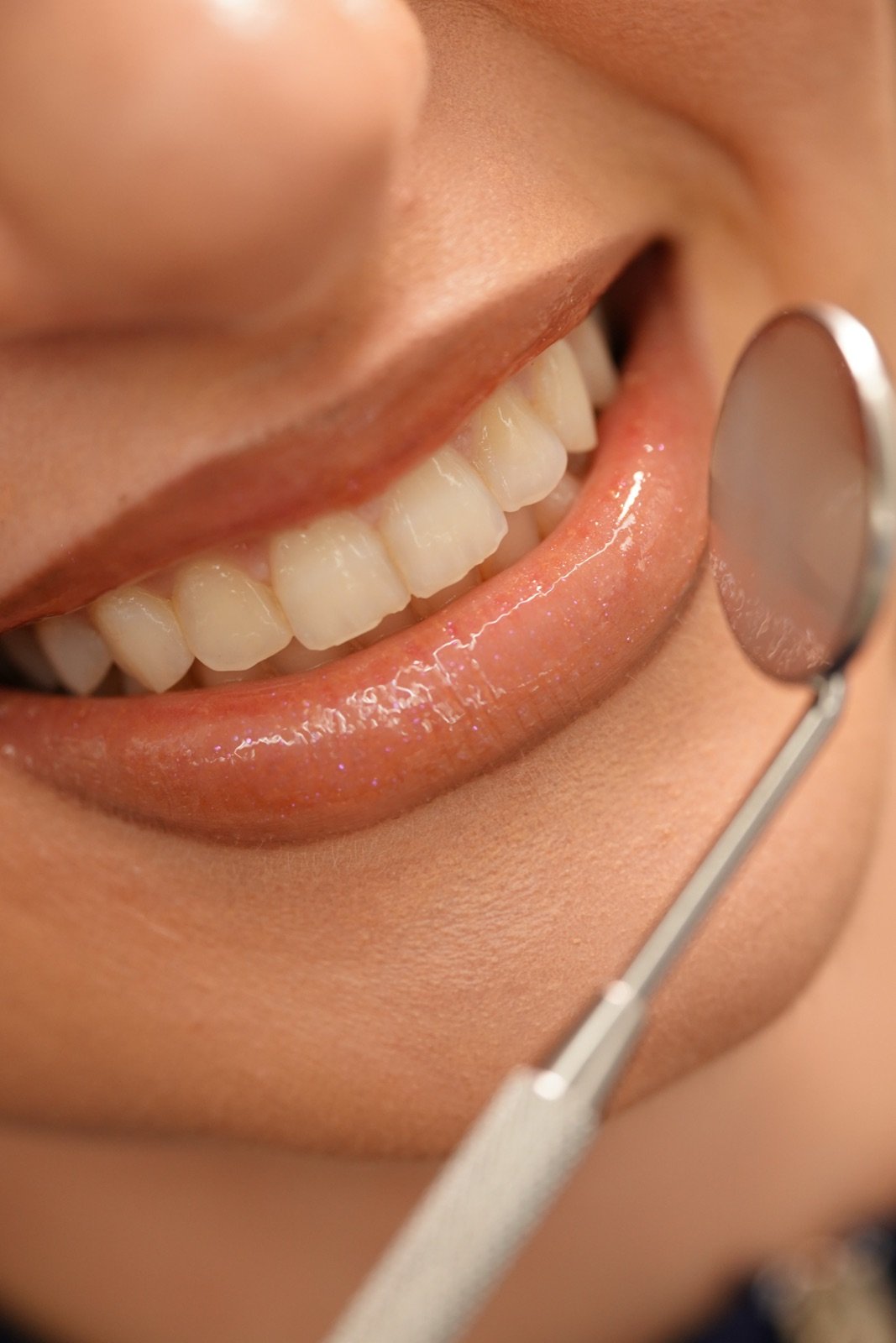 Kontroll i dhëmbëve me pasqyrë dentare