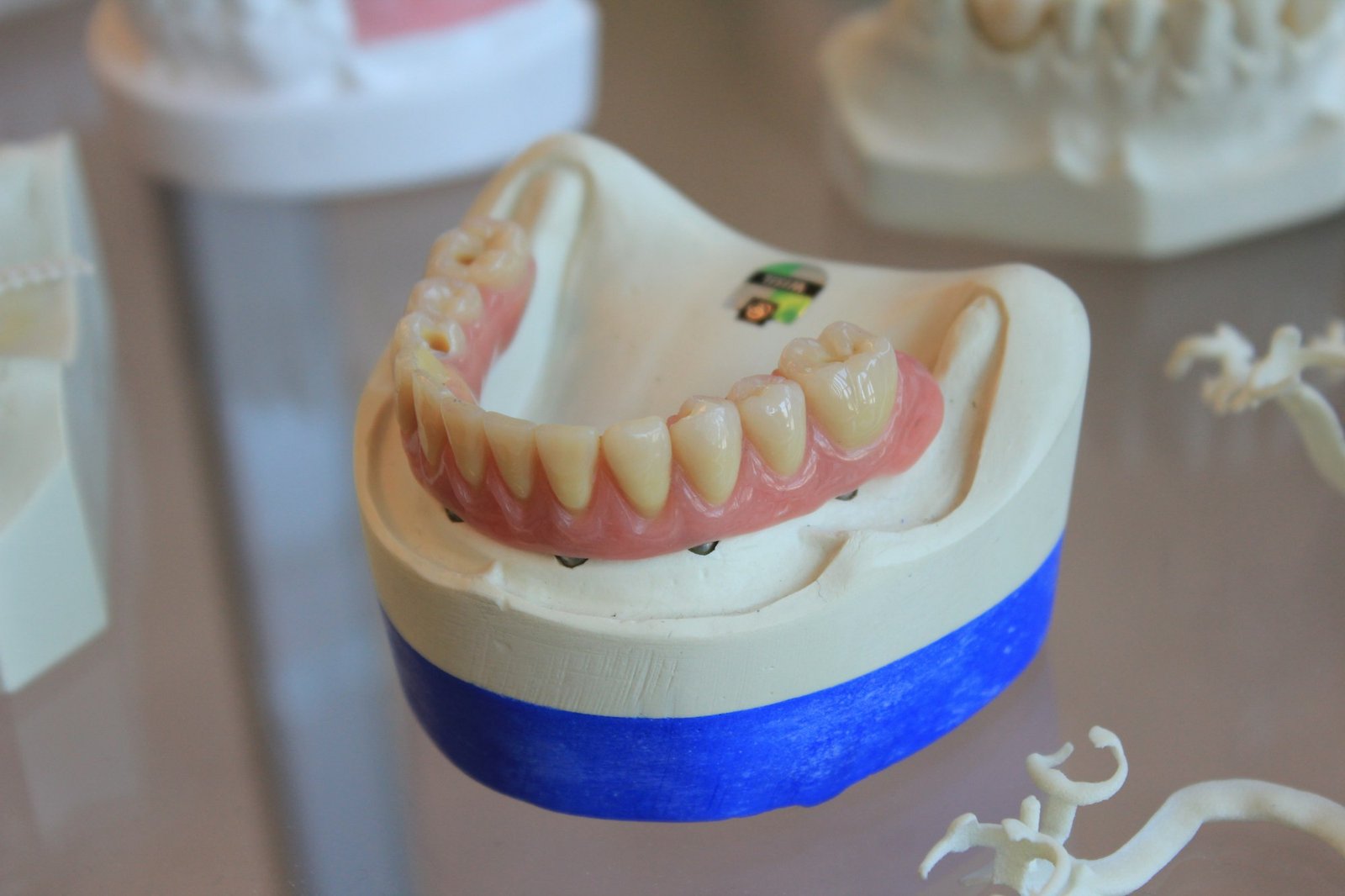All-on-4 / All-on-6 me implante dentare – Happy Dent Center