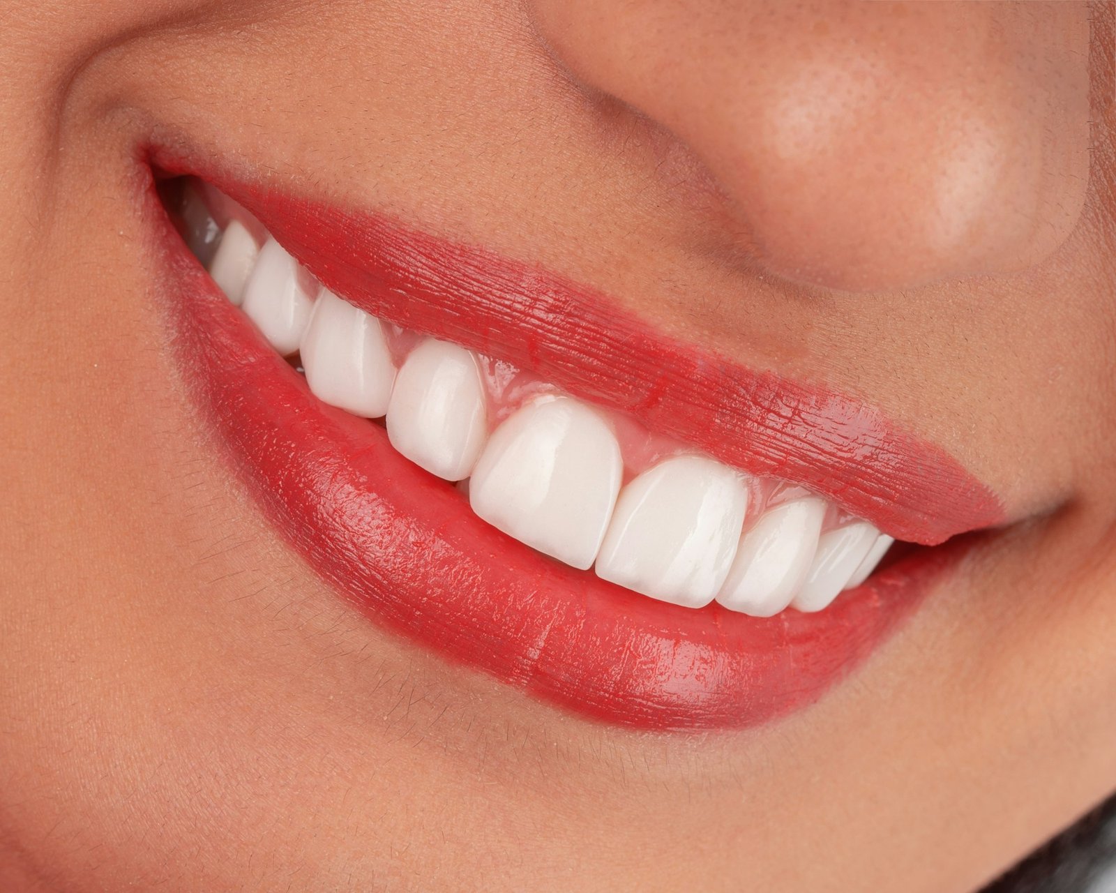 Faseta dhe kurora E-max – Happy Dent Center