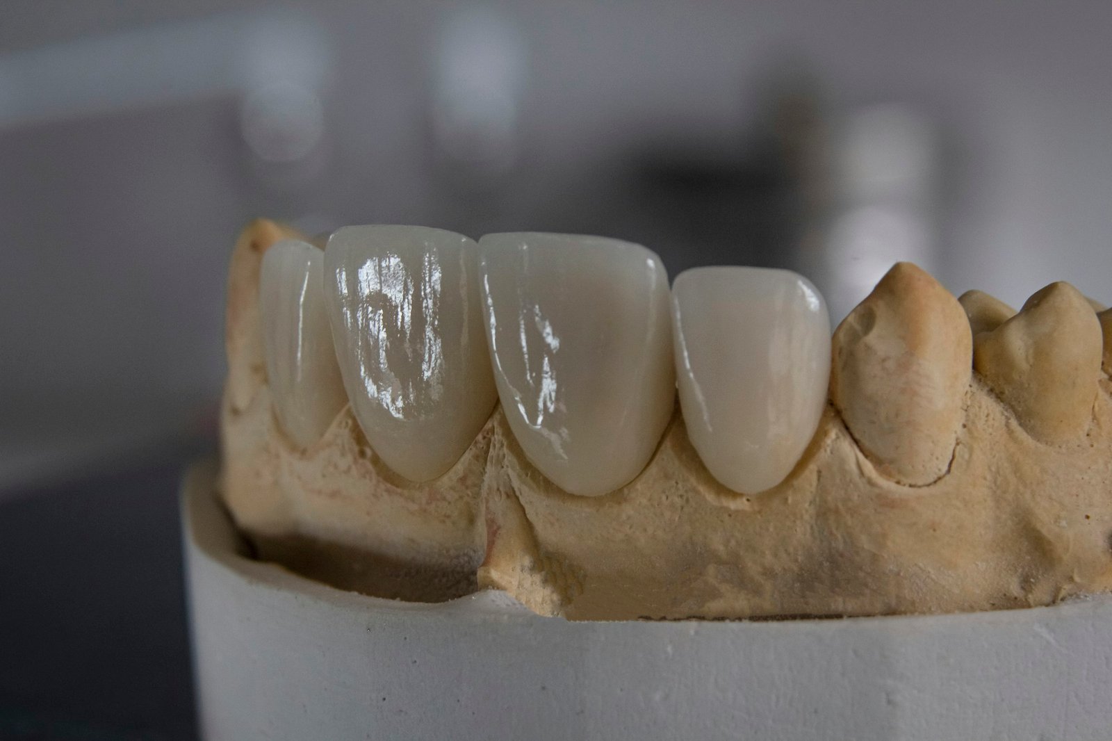 Kurora dentare – Happy Dent Center
