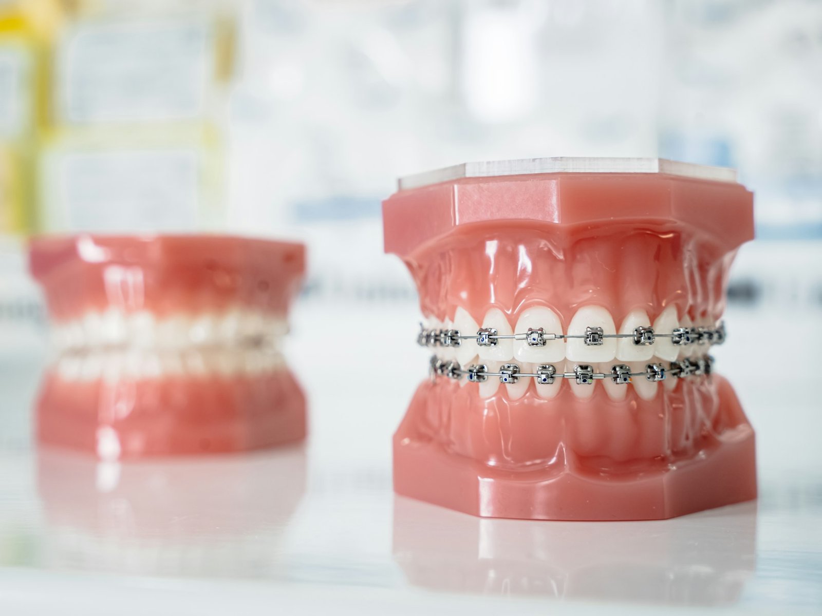 Trajtim ortodontik me aparat estetik – Happy Dent Center
