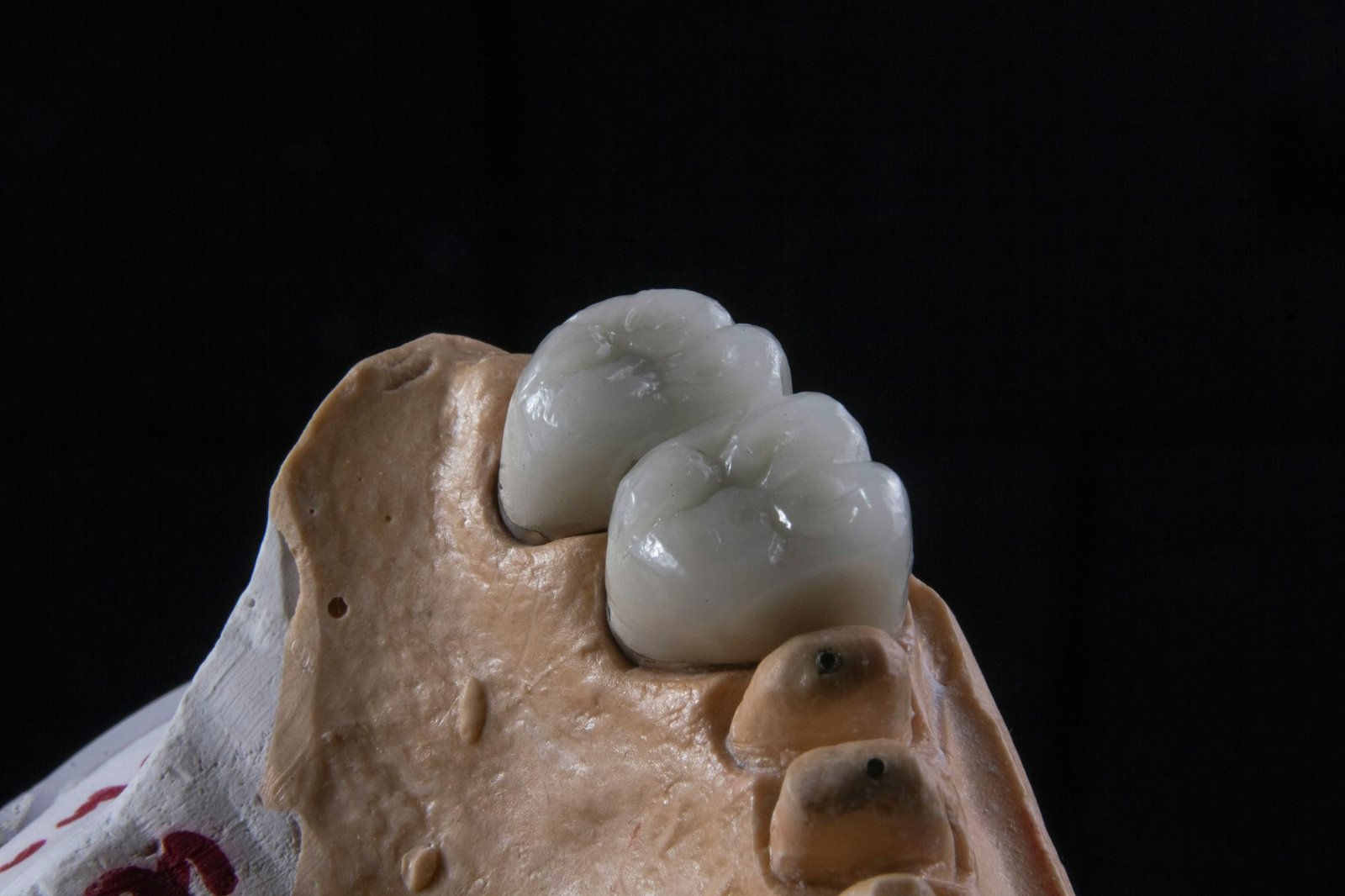 Urat dentare – Happy Dent Center