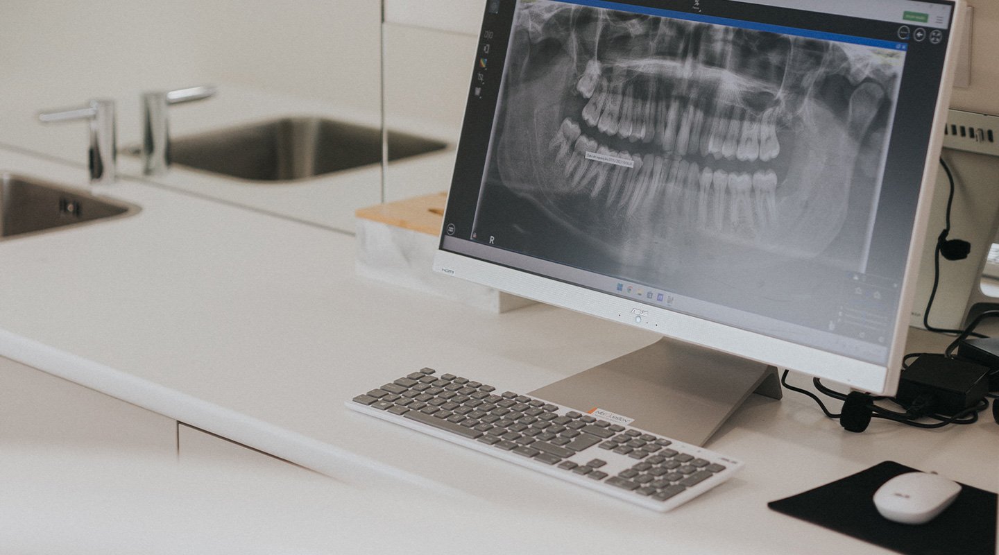 Radiografi panoramike dentare – Kirurgji orale në Happy Dent Center